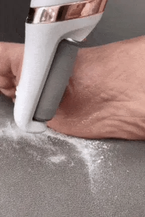 Electric Foot File & Callus Remover